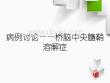 病例讨论——桥脑中央髓鞘溶解症