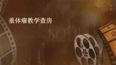 垂体瘤教学查房