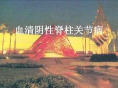 血清阴性脊柱关节病课件