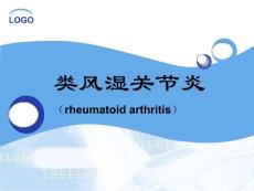 风湿性关节炎ppt课件