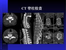 脊柱肿瘤PPT课件.ppt