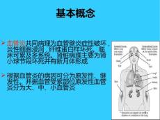 原发性血管炎课件