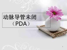 动脉导管未闭课件