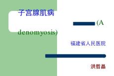 子宫腺肌病