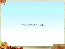阵发性室性心动过速课件