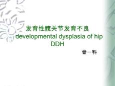 发育性髋关节发育不良_2