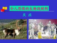 炭疽