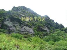 胫腓骨干骨折课件ppt