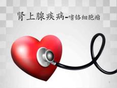 嗜铬细胞瘤课件