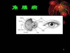 角膜病课件