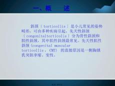 先天性肌性斜颈的康复概述.pptx
