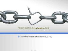 颅内静脉窦血栓形成ppt课件
