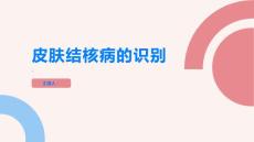 皮肤结核病不容忽视如何正确识别症状