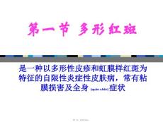 医学专题第十一章红斑鳞屑性皮肤病.ppt