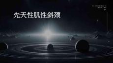 先天性肌性斜颈