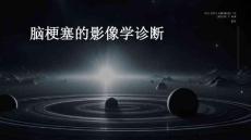 脑梗塞的影像学诊断与“脑梗塞”有关PPT文档