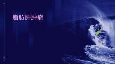 脂肪肝肿瘤