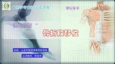认知骨折-骨折段移位