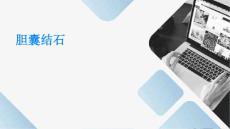 胆囊结石