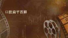 口腔扁平苔藓