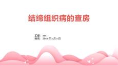 结缔组织病的查房