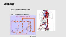动脉导管未闭课件