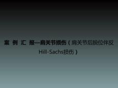 肩关节损伤肩关节后脱位伴反hill-sachs损伤-课件