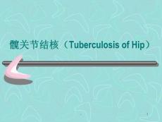 髋关节结核