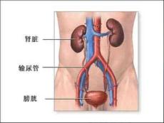 紫癜性肾炎.ppt