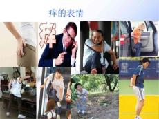 老性皮肤瘙痒症.ppt