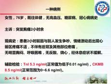 应激性心肌病