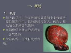 肺大泡疱的诊治.ppt