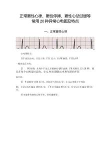 正常窦性心律、窦性停搏、窦性心动过缓等常用20种异常心电图及特点.docx