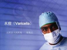 水痘varicella课件