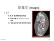 跟骨骨折影像学
