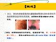 小儿消化性溃疡详解.ppt