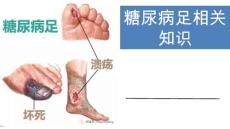 糖尿病足知识