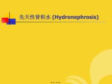 肾积水的护理(与“肾积水”相关)共18张PPT