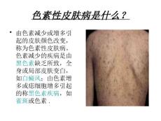 皮肤病