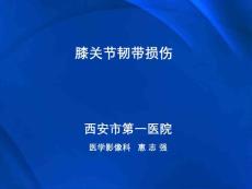 膝关节韧带损伤综述