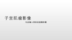 子宫肌瘤影像
