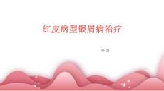 红皮病型银屑病治疗