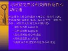 阵发性室上性心动过速(精选)