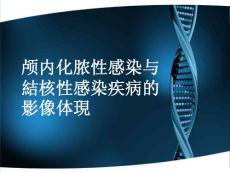 脑脓肿与脑结的影像表现