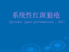 系统性红斑狼疮