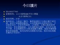 眼眶表皮样囊肿