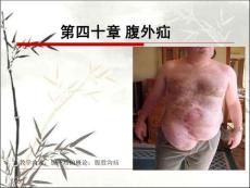 腹外疝-课件