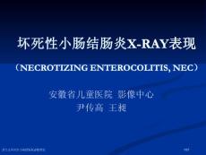 新生儿坏死性小肠结肠炎影像表现