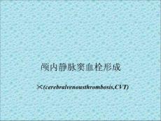 颅内静脉窦血栓形成