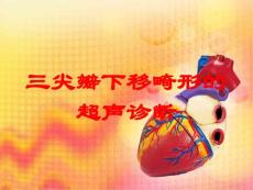 医学医疗-三尖瓣下移畸形的超声诊断培训课件